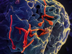 SEM image of the Ebola Virus